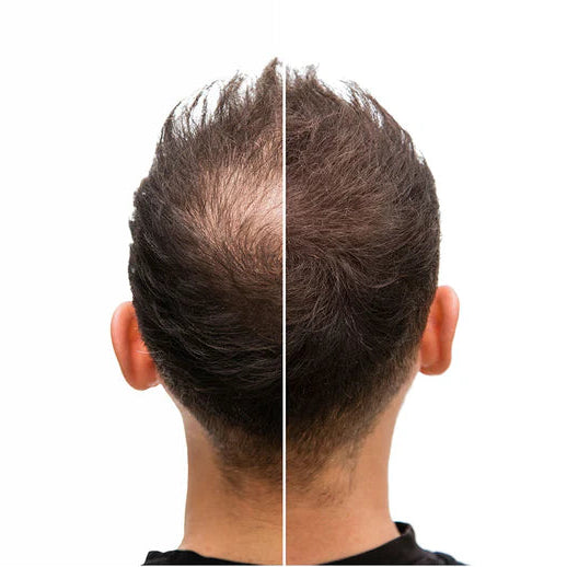 Loción para estimular el crecimiento del cabello