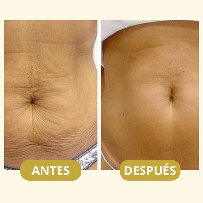 Aceite original corporal mágico Besque™