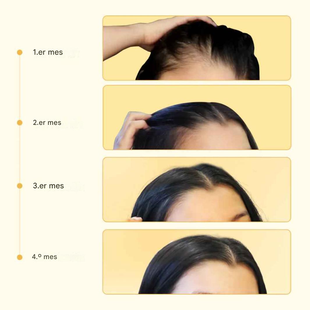 Aceite para el crecimiento del cabello