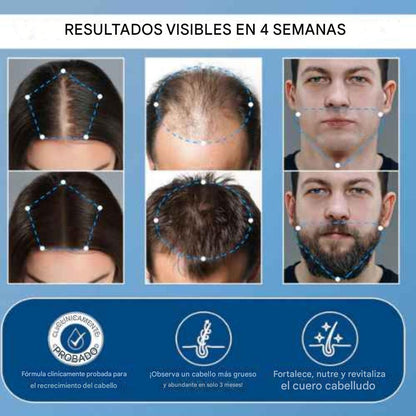 Suero roll-on para el crecimiento del cabello avanzado
