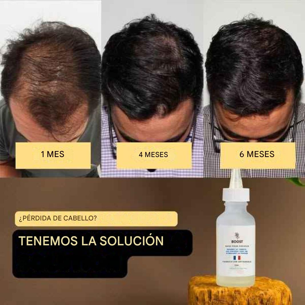 Loción para estimular el crecimiento del cabello