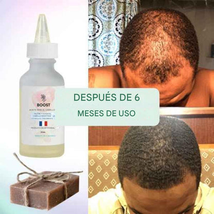 Loción para estimular el crecimiento del cabello