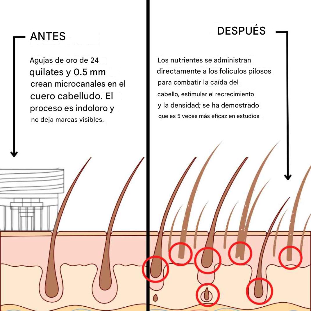 ALPHAINFUE REACTIVA AL INSTANTE EL CRECIMIENTO DEL CABELLO