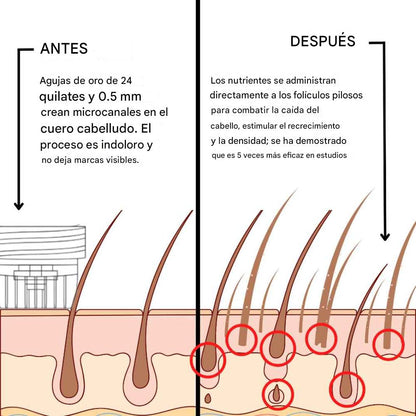 ALPHAINFUE REACTIVA AL INSTANTE EL CRECIMIENTO DEL CABELLO