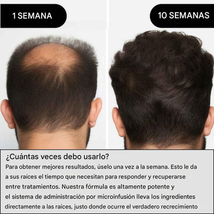 ALPHAINFUE REACTIVA AL INSTANTE EL CRECIMIENTO DEL CABELLO